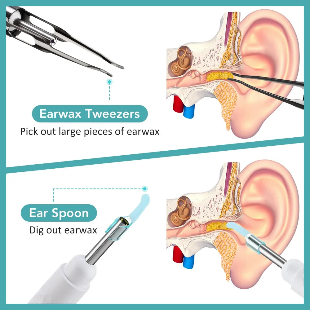 Visual Ear Wax Cleaner and Otoscope Camera for Safe Home Ear Canal Cleaning - 2