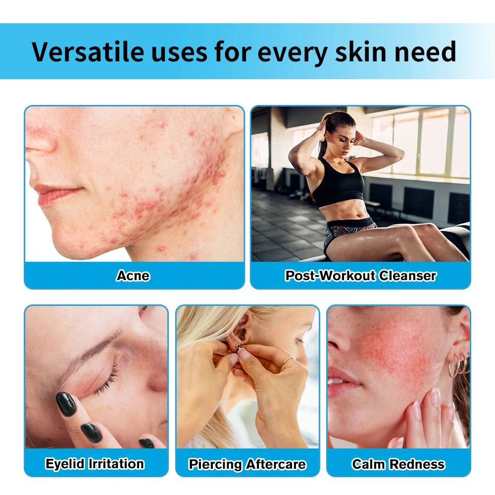 Hypochlorous Acid Spray and Facial Toner for Daily Skin Rescue and Calming