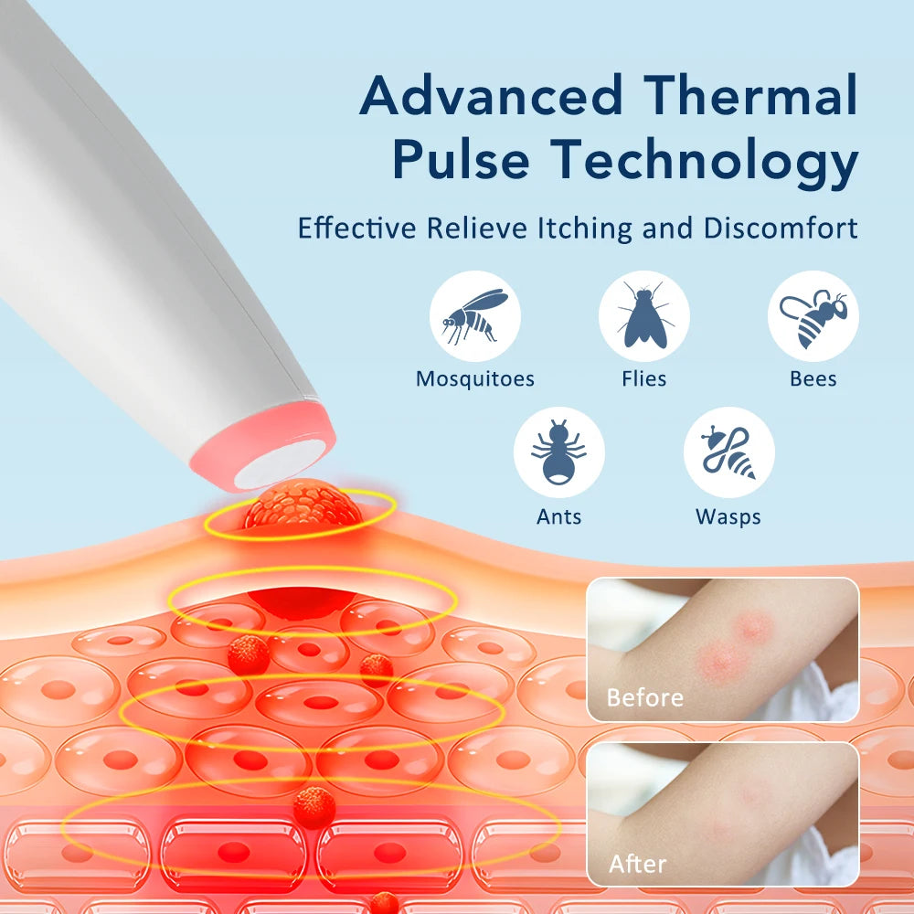 Electric Itch Relief Pen and Insect Bite Soother for Outdoor Summer Travel