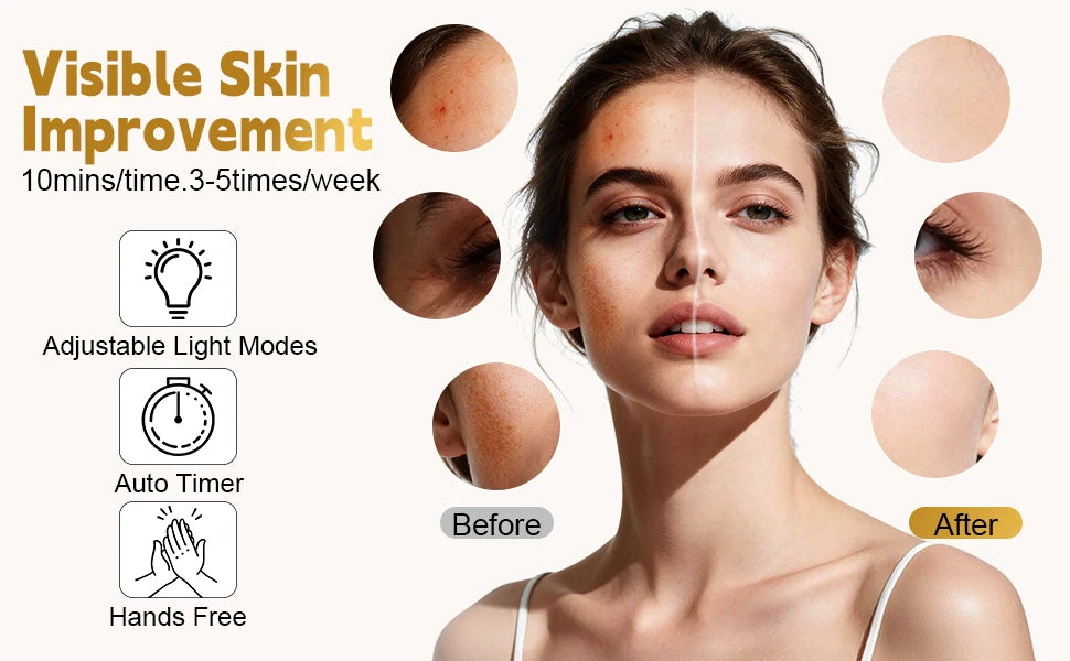 LED Face Mask and Light Therapy Device for Professional Skincare at Home Treatments - 9